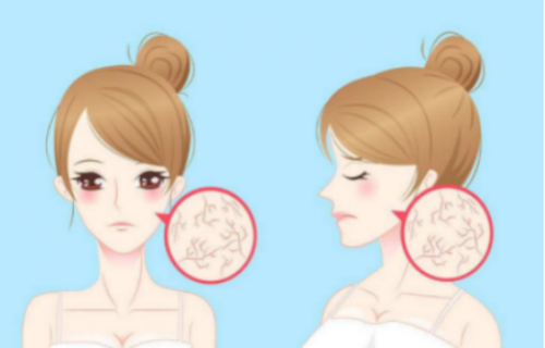 女人眼角有皱纹怎么办 助你快速去皱纹的方法