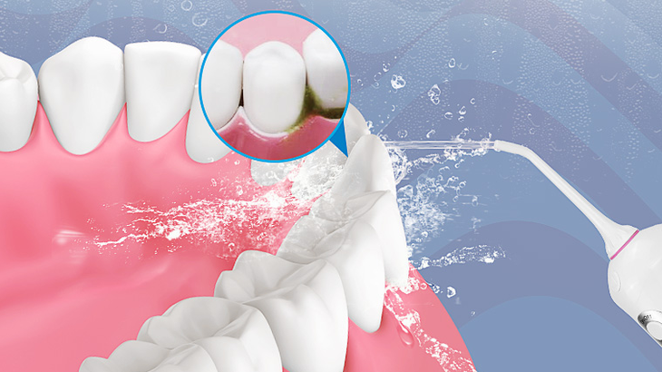 全面清洁口腔细菌_-泡泡网